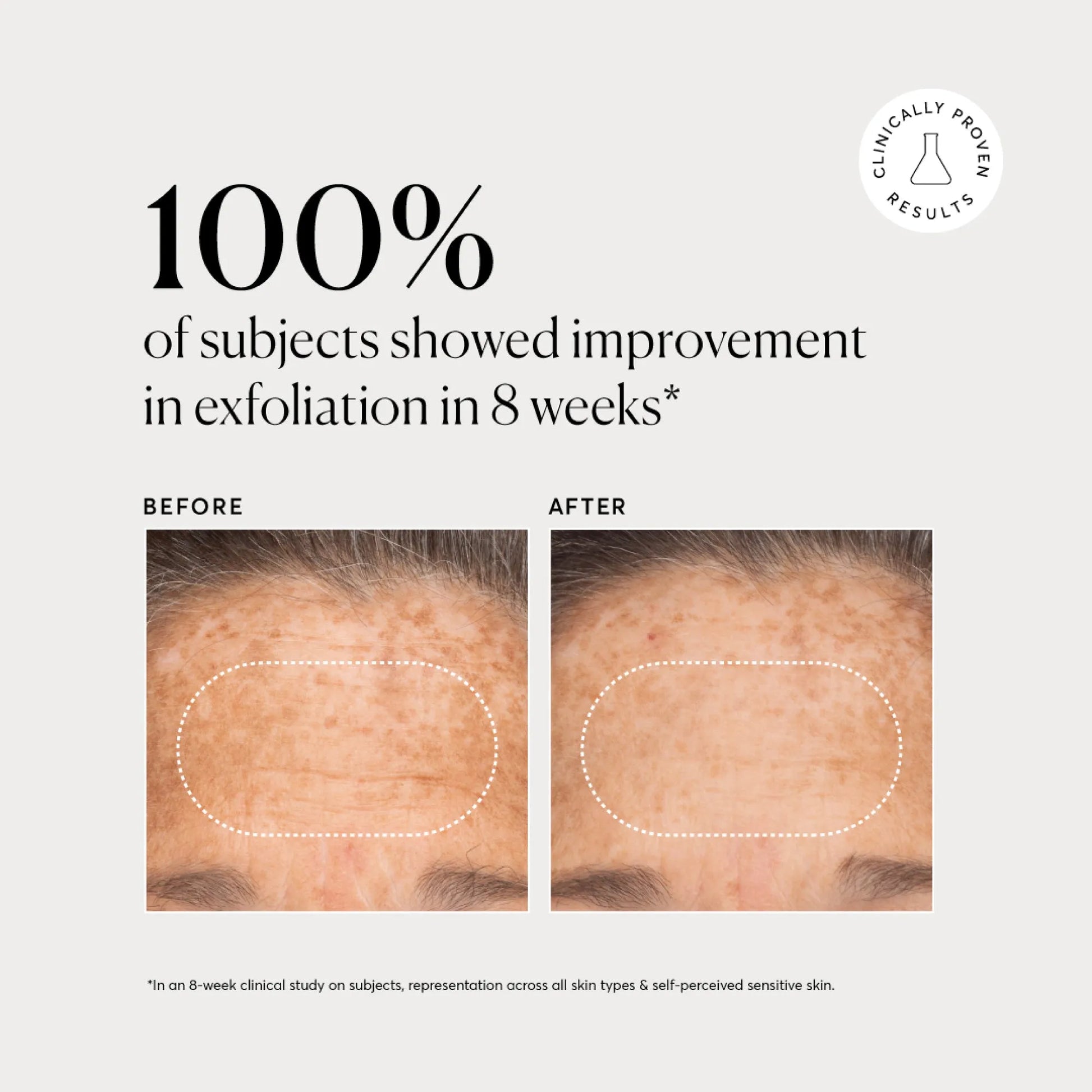 bha-liquid-exfoliant-2-i5 NATR-10027-Alt-Images-BHA-Liquid-Exfoliant-2_-03.webp